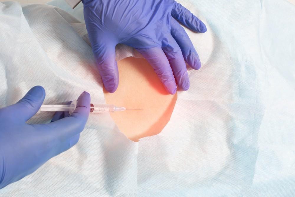Benefits of Epidural Shots for Back Pain in Tulsa: