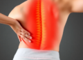 Can Gerd Cause Back Pain