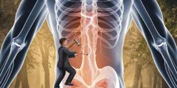 How Can Stiff And Tight Muscles Result In Back Pain