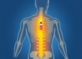 How Long Does a Toradol Shot Last For Back Pain