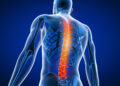 COVID Back Pain