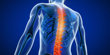 COVID Back Pain