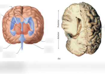 Where To Find Hotnoidazic