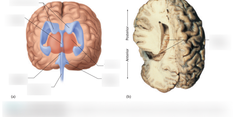 Where To Find Hotnoidazic